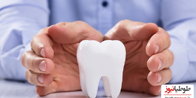 پوشش دندانپزشکی بیمه تکمیلی چه خدماتی دارد؟